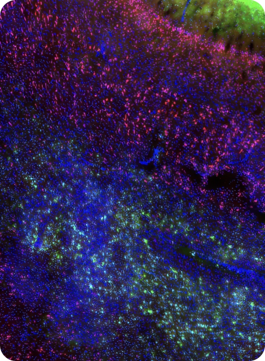 Respresentative image of the brain model